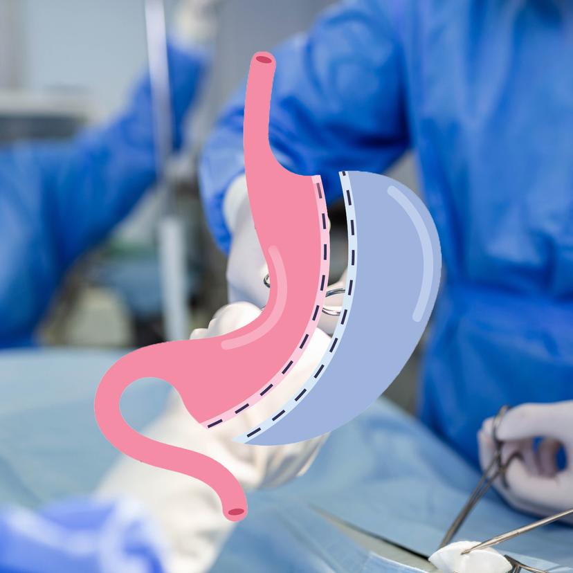 Service Gastric Laparoscopic Surgery Center Image