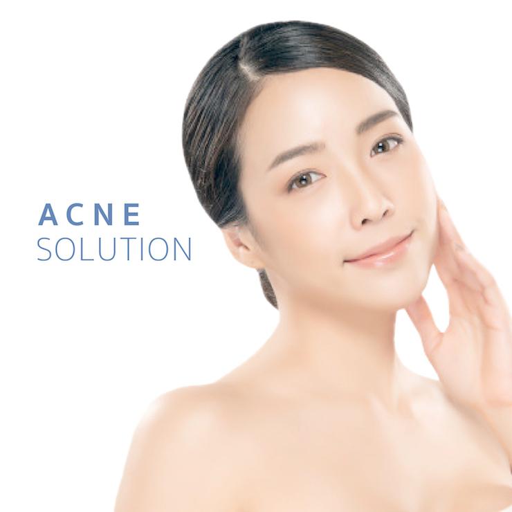 Service Acne Solutions Image