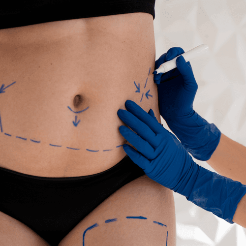 Service CoolSculpting Image