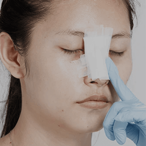 Service Rhinoplasty Services Image