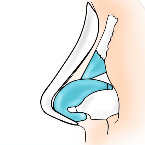 Service Close Rhinoplasty Image