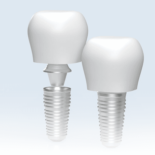 Service Transform Your Smile with Dental Implants Image