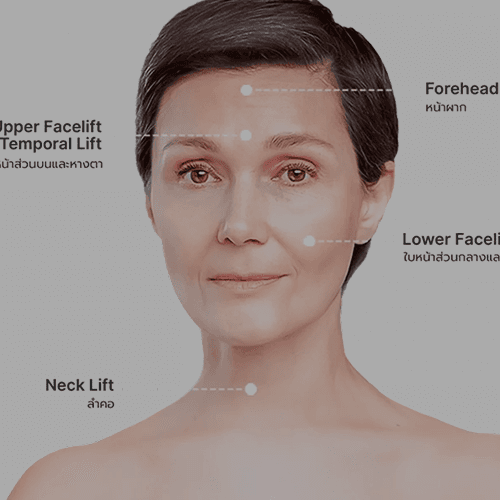 Service 4-Point Face Pulling Program Image