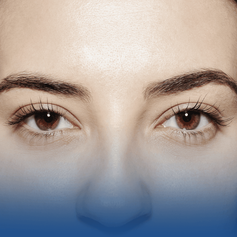 Service Double Eyelid Surgery Image