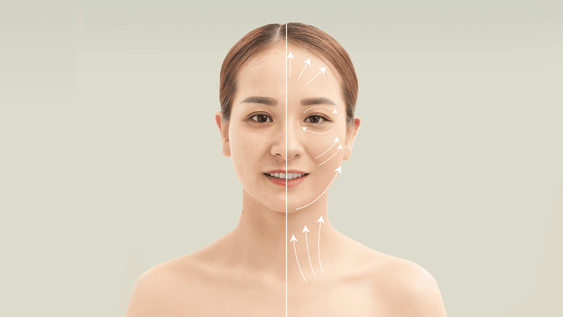 Blog: Choosing the Right Facelift in Thailand: An Expert Guide