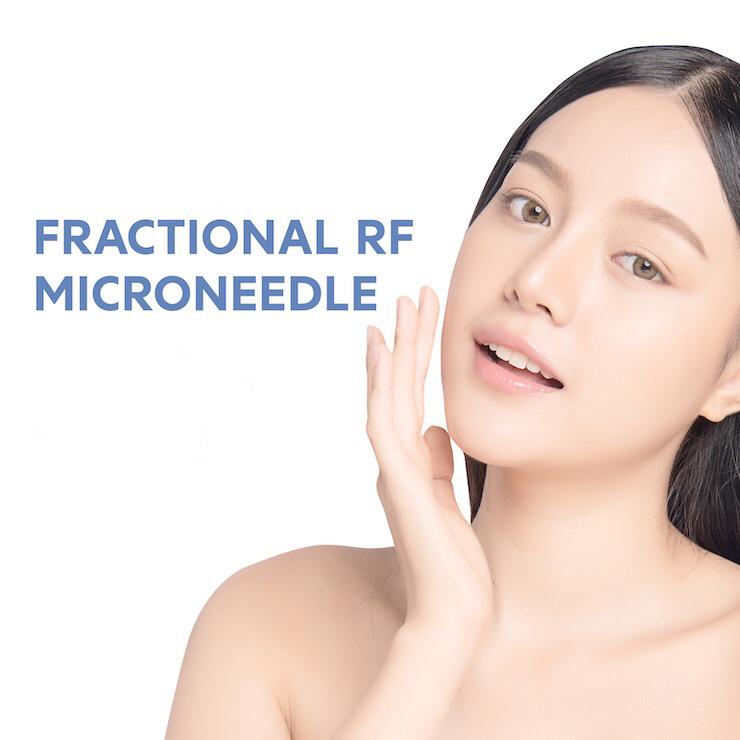 Service Fractional RF Microneedle Image