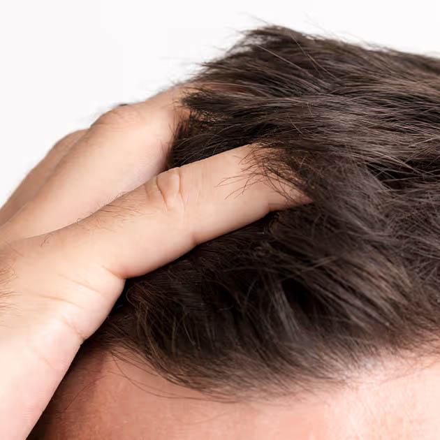 Service Hair Restoration Clinic: Rediscover Your Confidence Image