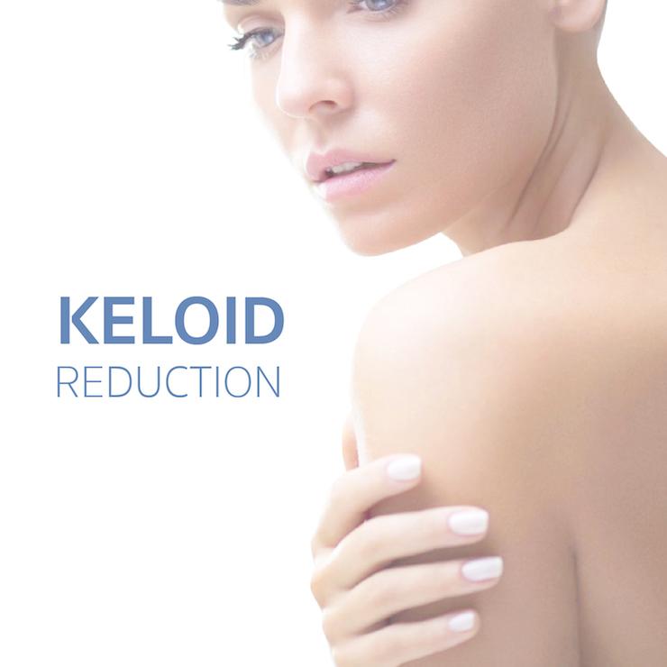 Service Keloid Reduction Image