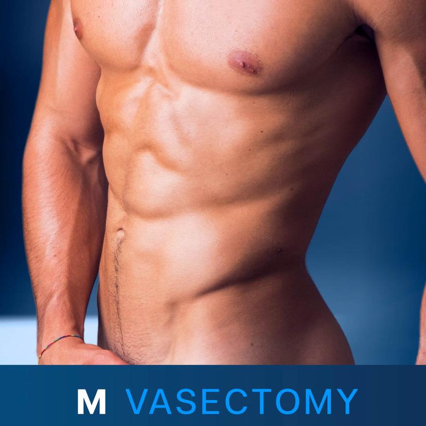 Service M Vasectomy: Male Sterilization Image