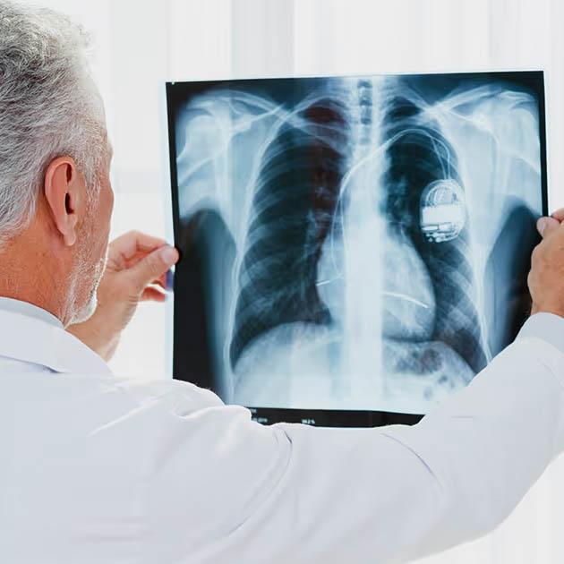 Service Pulmonary Center Image