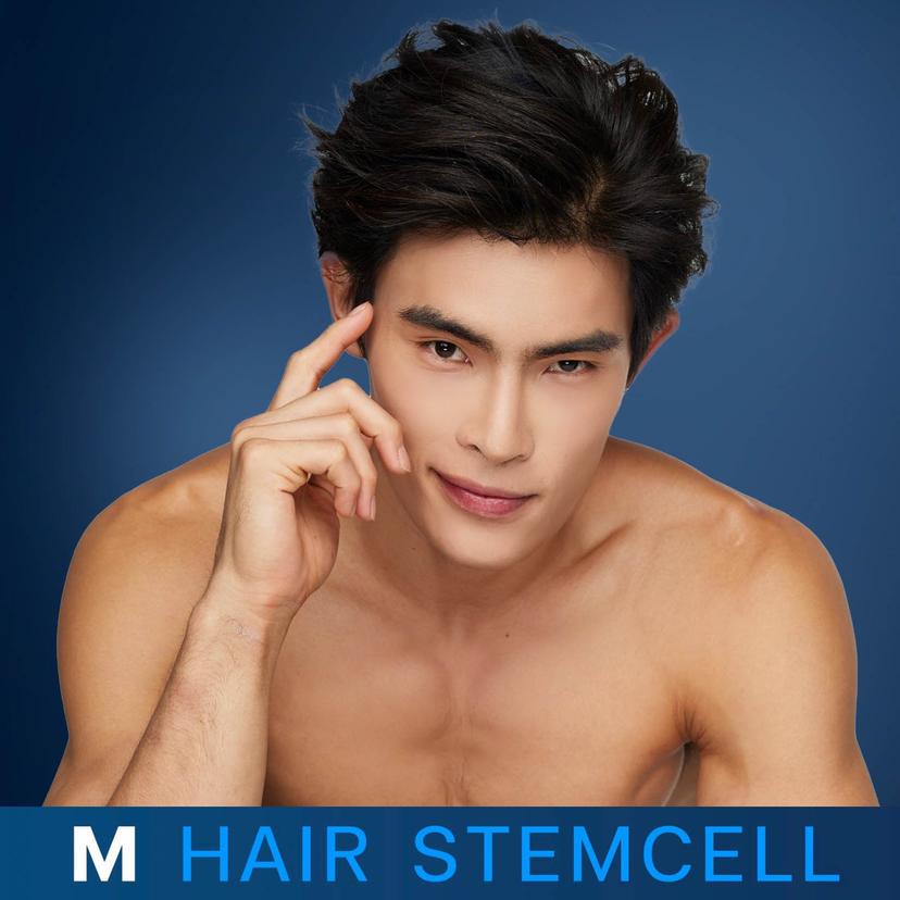 Service M Hair Growth: Autologous Stem Cell Image