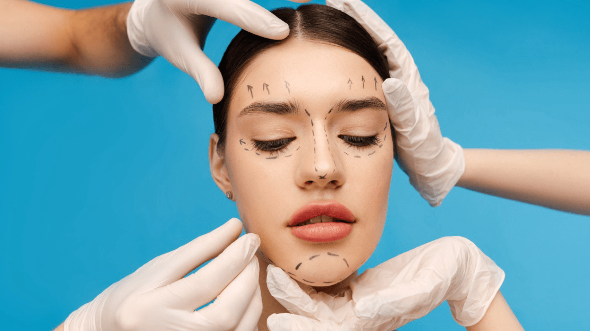 Blog: The Ultimate Guide to Thread Lifts for a V-Shape Face and Youthful Glow