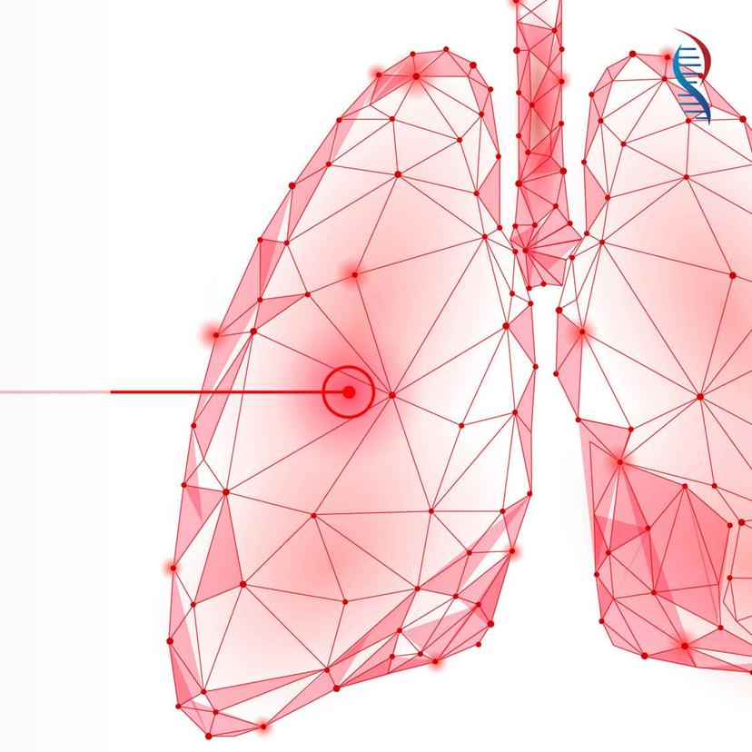 Service Comprehensive Tuberculosis Testing Image