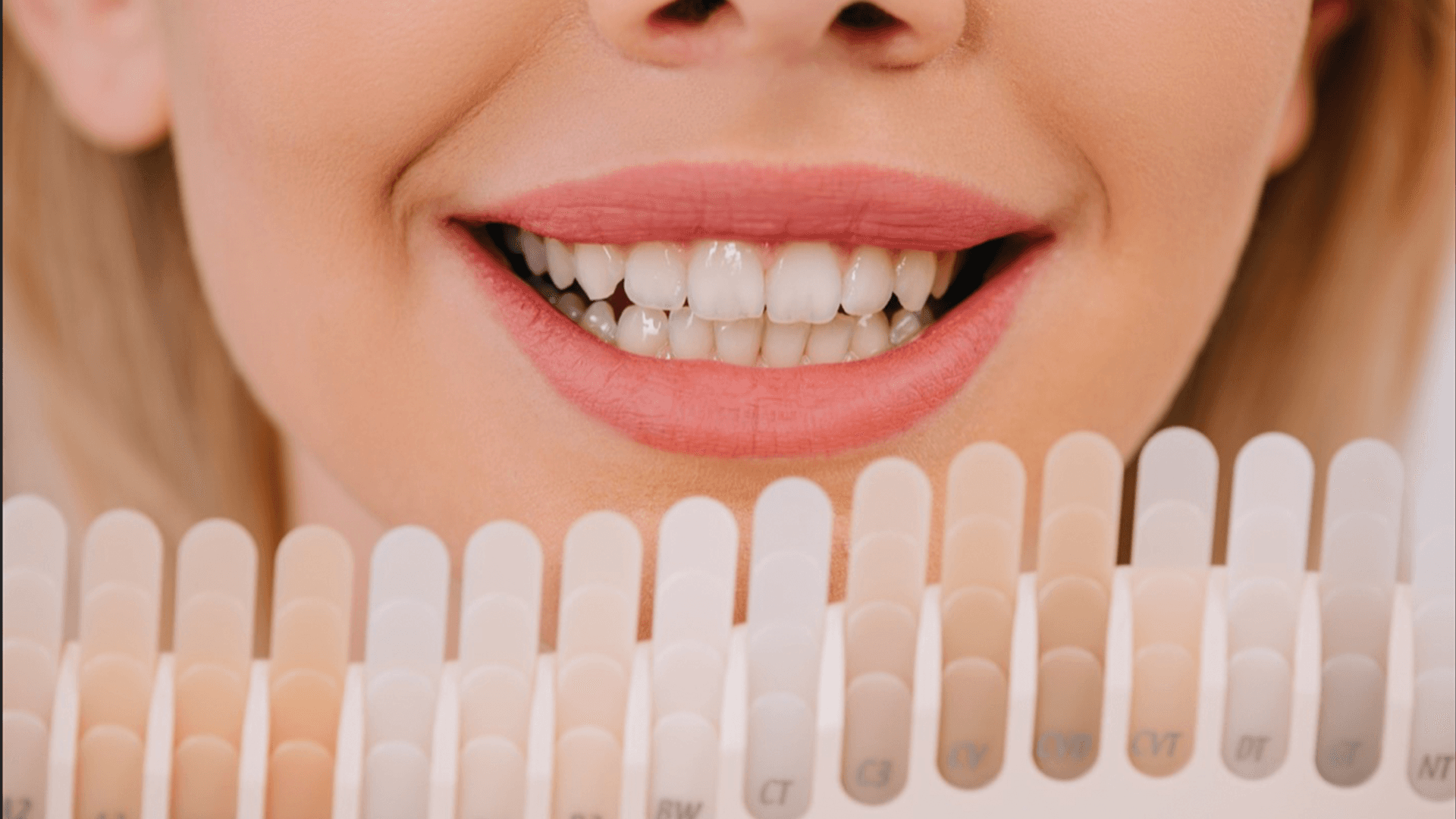 Blog: Veneers: Enhancing Your Smile with Natural-Looking Dental Solutions