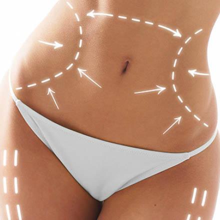 Service Mini-Abdominoplasty Image