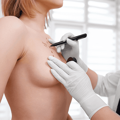 Service Breast Surgery Image