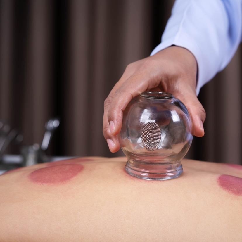 Service Discover the Time-Honored Healing of Cupping Therapy Image